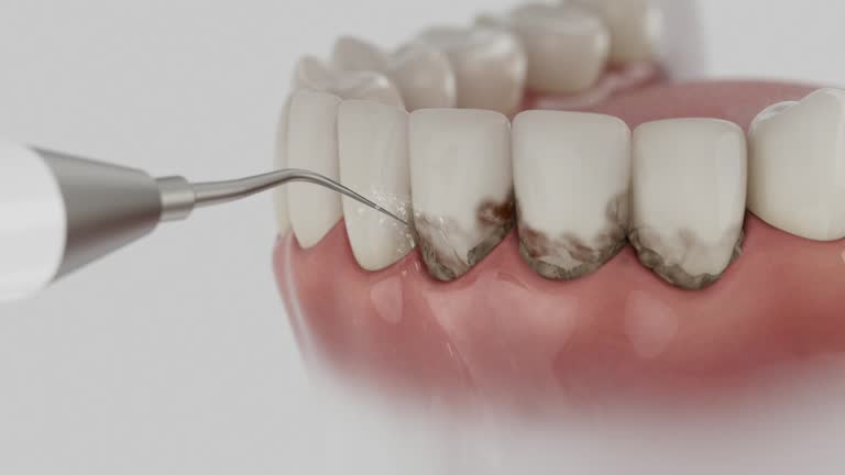 Reliable Tooth Extraction contractor in Five Points, FL by Smile Center Dentistry